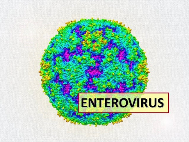 Phần lớn các trường hợp viêm màng não do Enterovirus thường tiến triển lành tính, sau quá trình điều trị, trẻ hồi phục hoàn toàn và không để lại di chứng (Hình ảnh minh họa: nguồn internet)