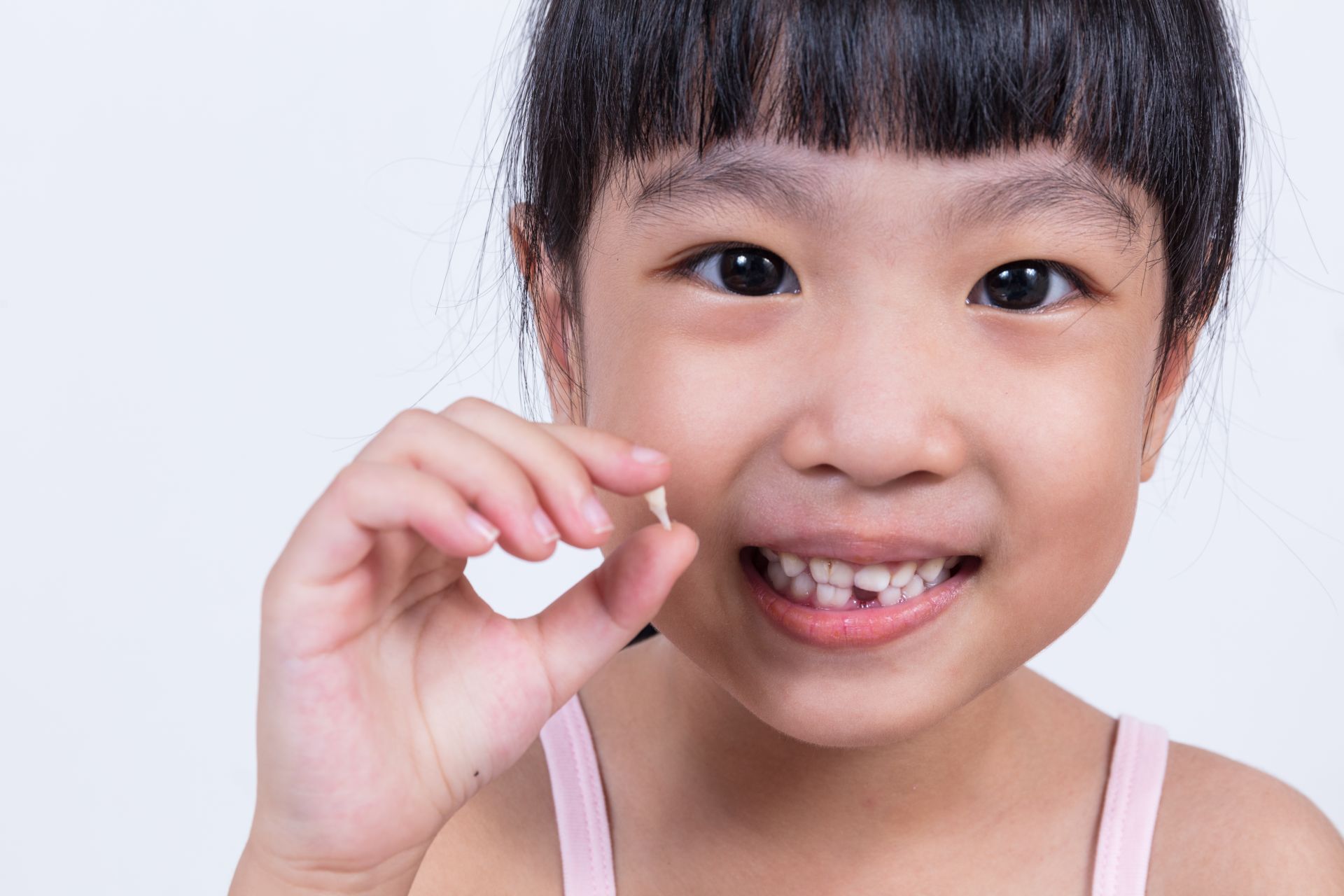 Va đập vùng mặt là một trong những nguyên nhân gây mất răng sớm Va đập vùng mặt là một trong những nguyên nhân gây mất răng sớm