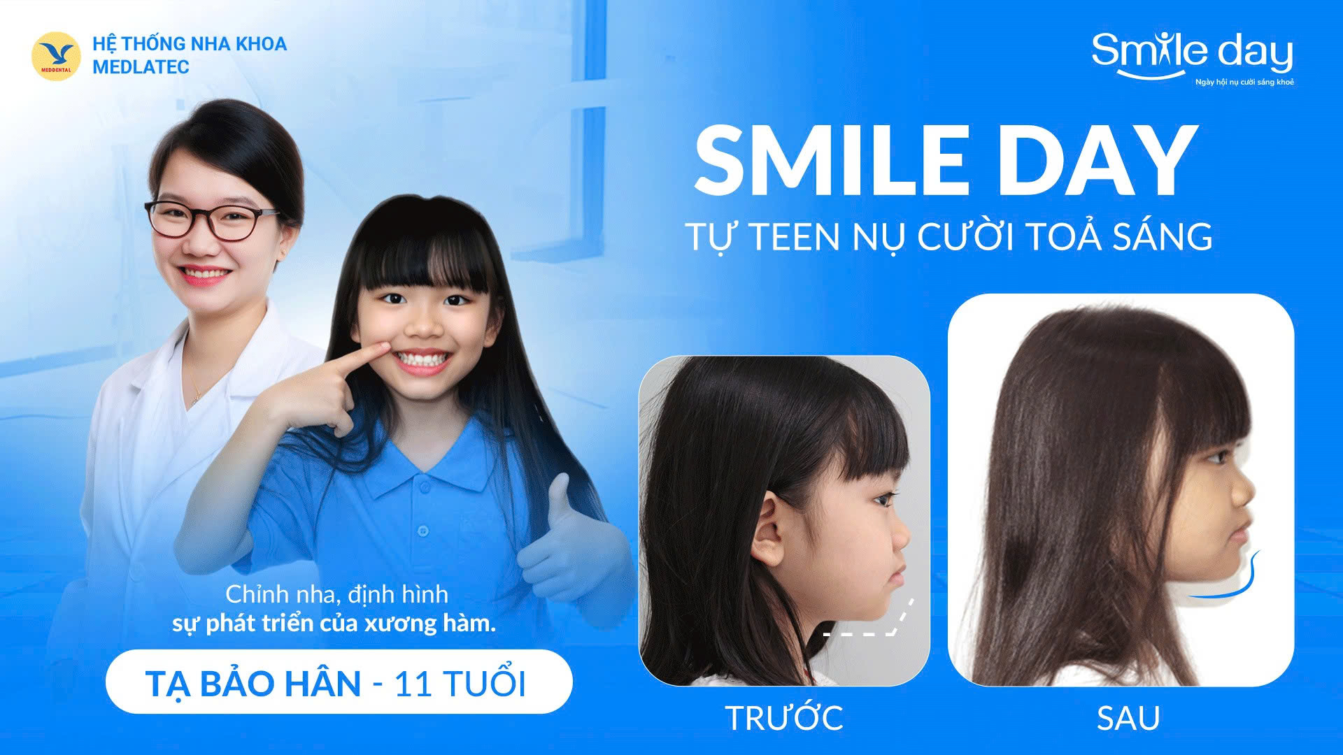 Chỉnh nha sớm giúp định hình khung xương hàm của trẻ Chỉnh nha sớm giúp định hình khung xương hàm của trẻ