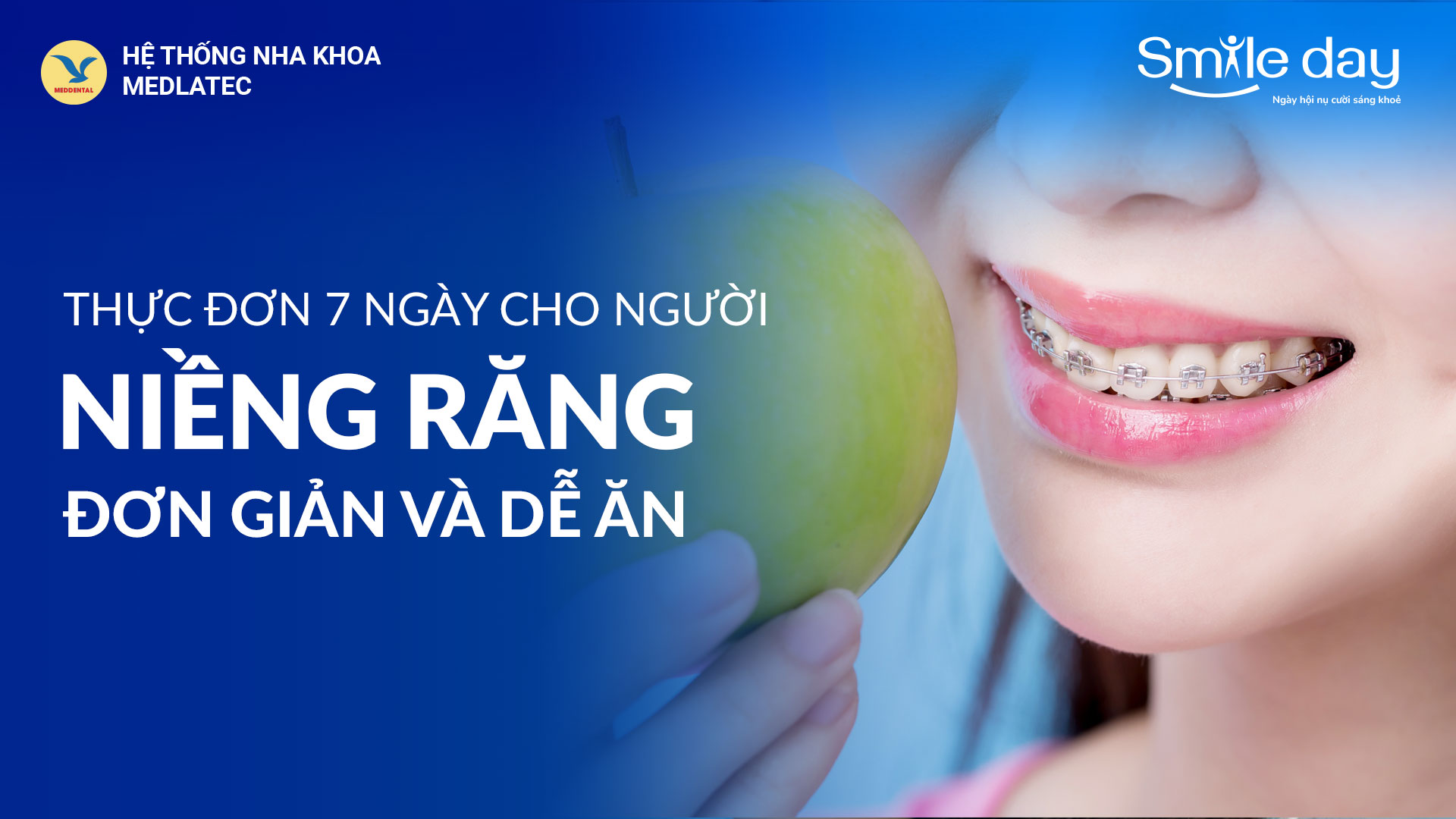 Xây dựng thực đơn đơn giản, dễ ăn cho người niềng răng