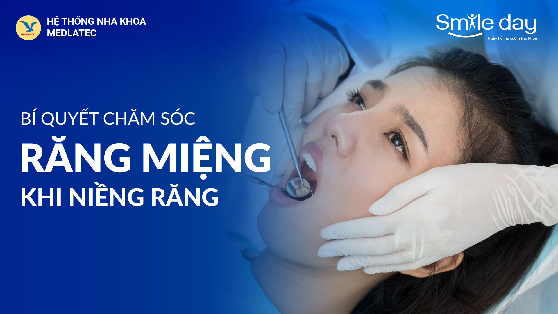 Bí Quyết chăm sóc răng miệng cho người niềng răng