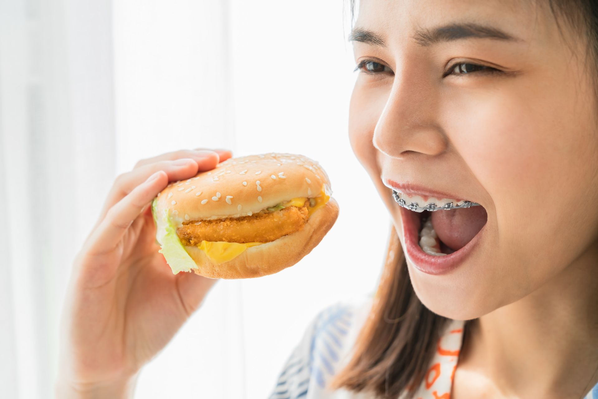 Dinh dưỡng đúng cách sẽ giúp quá trình niềng răng nhẹ nhàng hơn Dinh dưỡng đúng cách sẽ giúp quá trình niềng răng nhẹ nhàng hơn