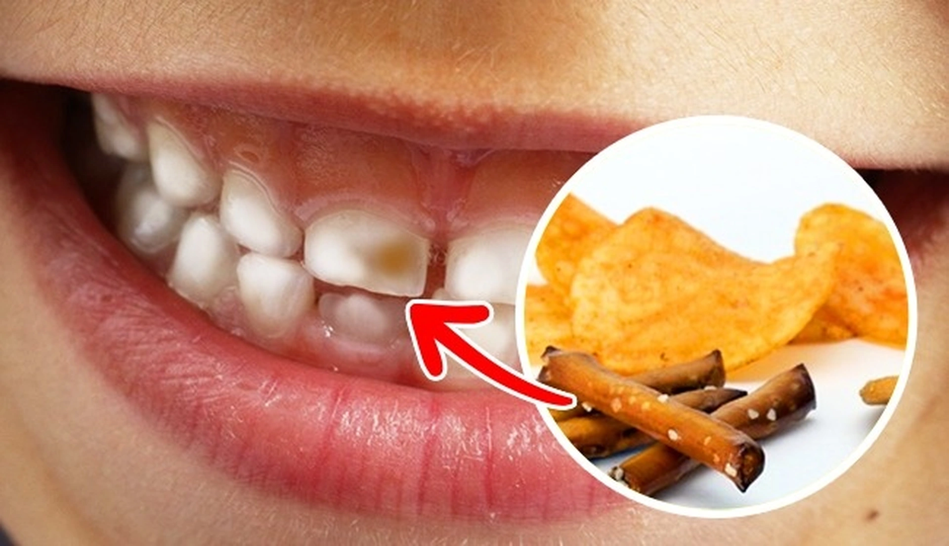 Những thực phẩm gây hại cho răng