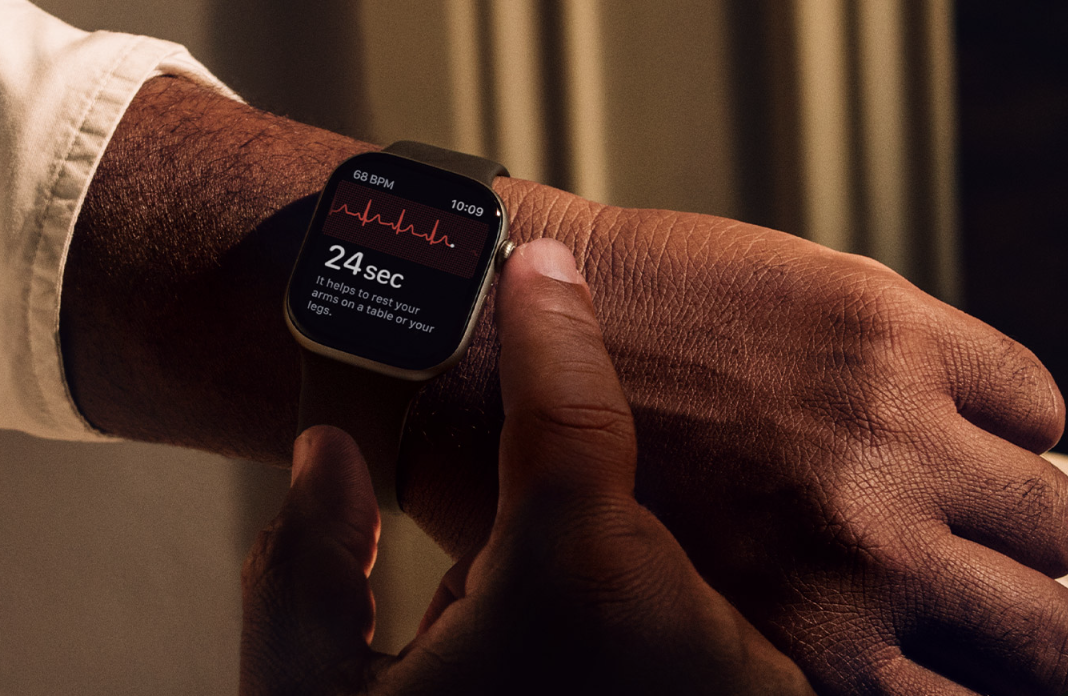 Apple Watch Series 11. Apple Watch Series 11.