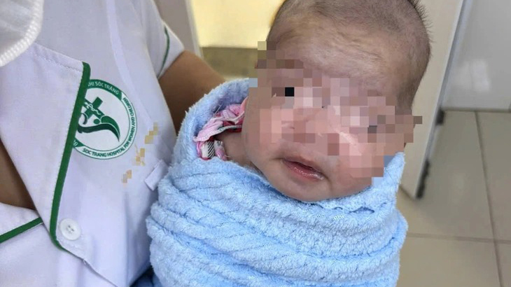 Trẻ sơ sinh 8 ngày tuổi bị uốn ván nặng