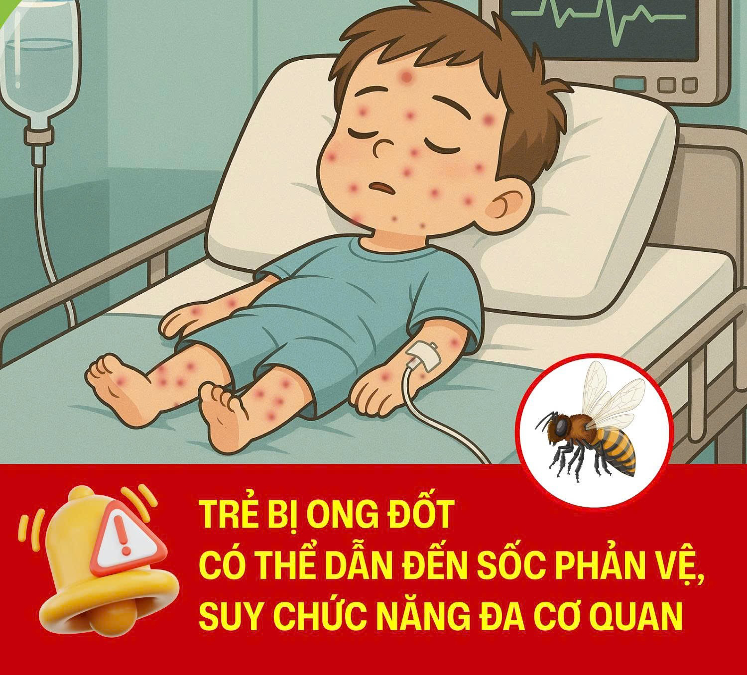 Trẻ em bị ong đốt có nguy cơ đối mặt với những vấn đề nghiêm trọng về sức khỏe. Trẻ em bị ong đốt có nguy cơ đối mặt với những vấn đề nghiêm trọng về sức khỏe.