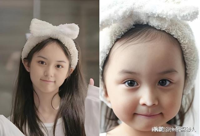 Lưu Sở Điềm bị cấm kh&ocirc;ng cho phẫu thuật thẩm mỹ .