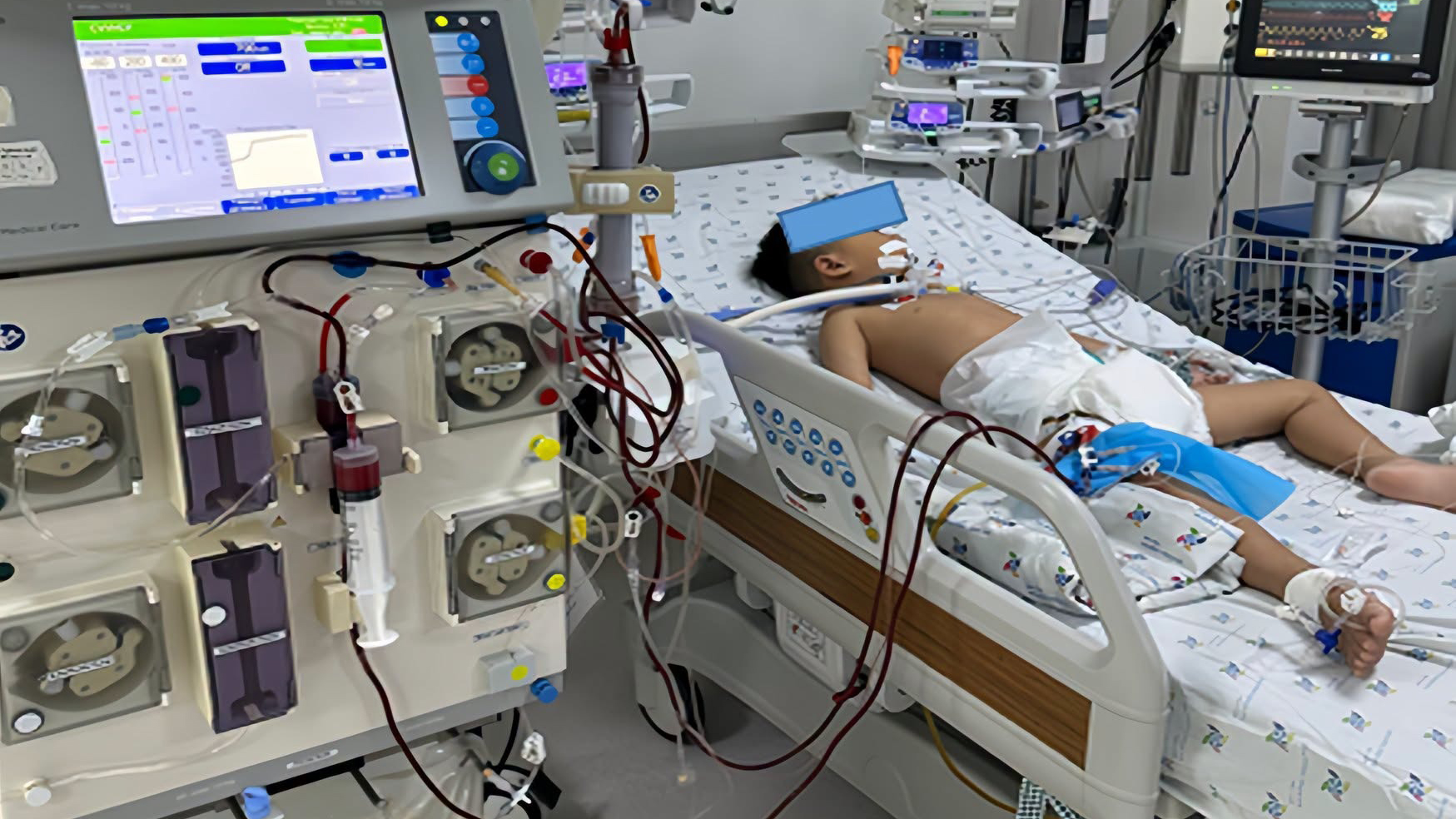Bệnh nhi được điều trị t&iacute;ch cực.
